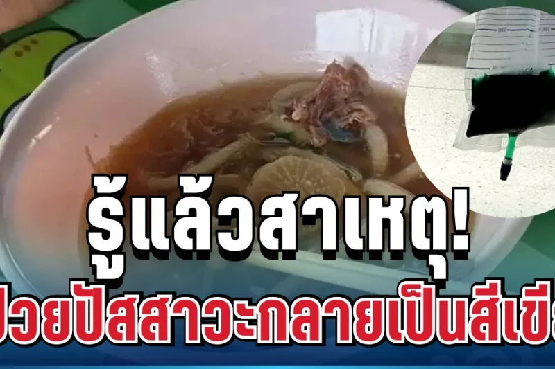 รู้แล้วสาเหตุ! ผู้ป่วยร้านก๋วยเตี๋ยวมรณะ ปัสสาวะกลายเป็นสีเขียว